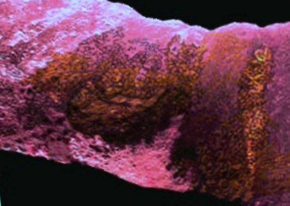 5391.ZIPS2 -SECOND.01