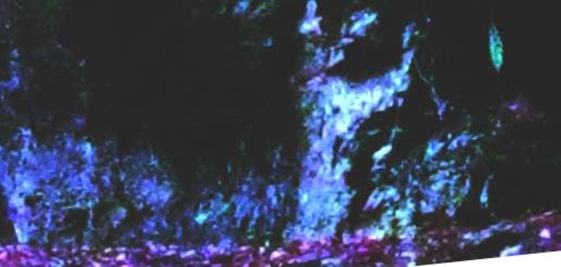 42895174_990610167777530_7241825021566386176_n